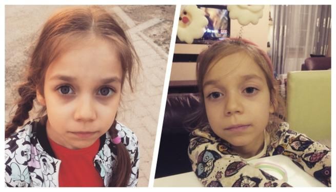 Na pierwszy rzut oka dziewczynka wygląda na zdrową. Jednak stan jej się pogarsza