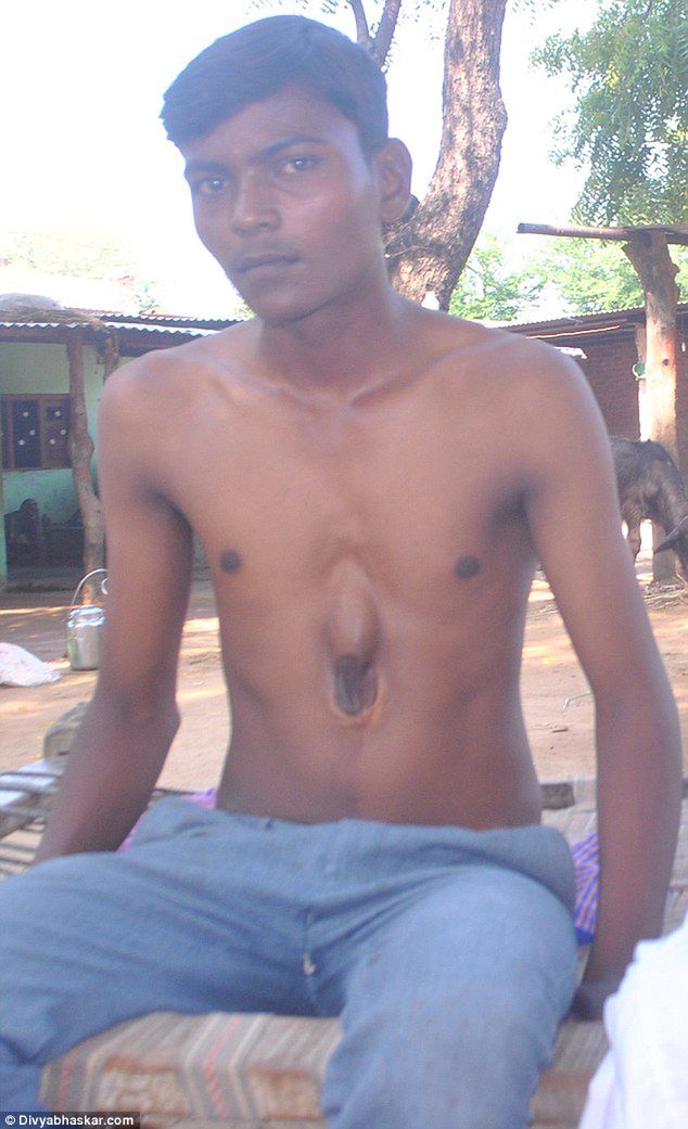 Arpit Gohil - &quot;medyczny cud&quot; z Indii