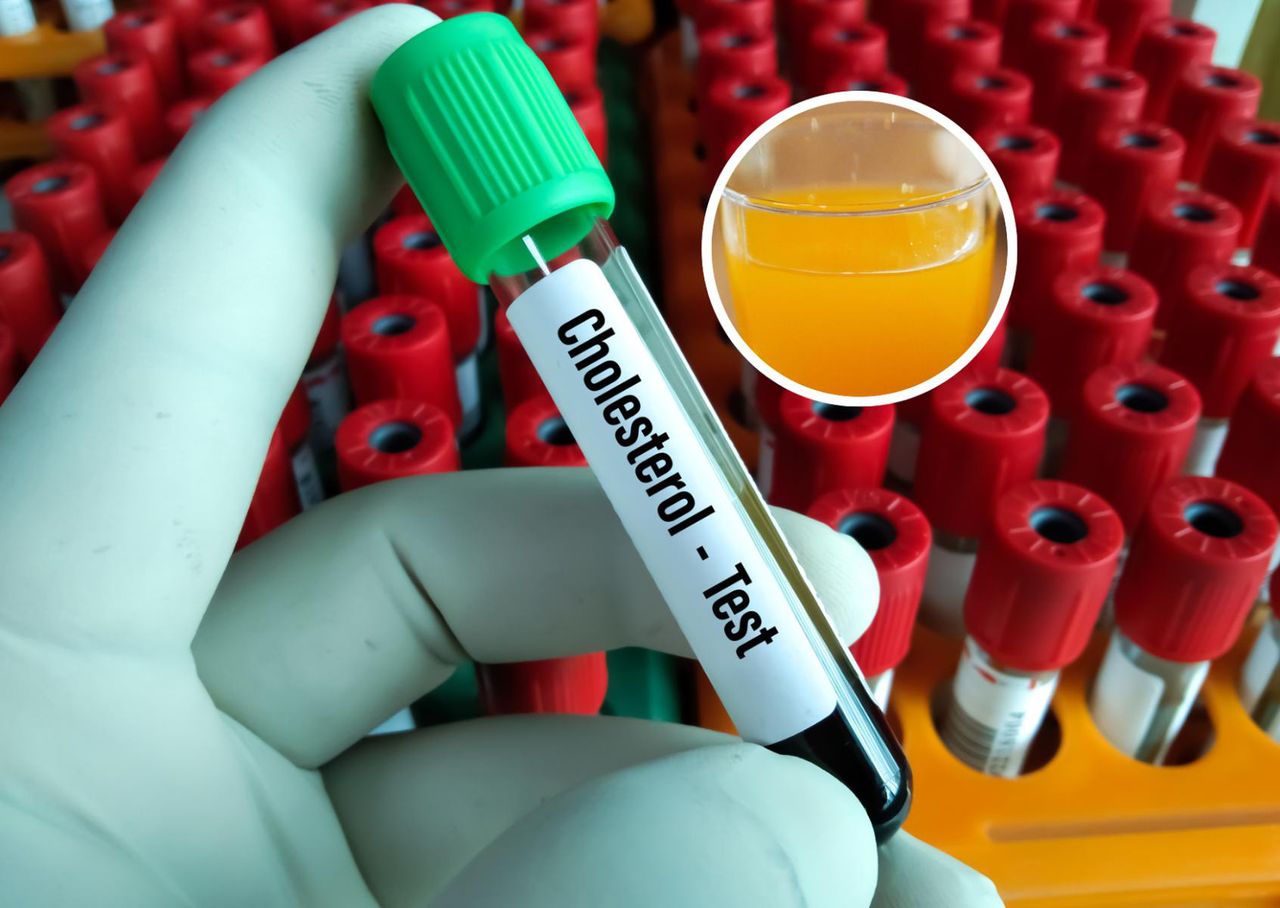 Tarcza ochronna dla serca. Pij, by obniżyć ciśnienie i cholesterol