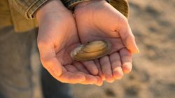 Brachydaktylia - przyczyny, objawy, metody leczenia