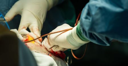 Podczas sekcji zwłok u pacjentów z COVID-19 odkryto skrzepy krwi w prawie każdym narządzie