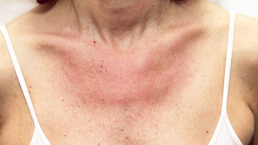 Niezwykłe objawy dysfunkcji trzustki. Nie lekceważ tych sygnałów