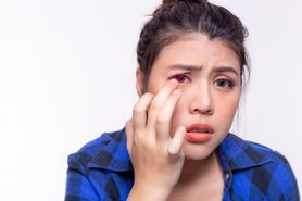 Bielmo na oku – przyczyny, objawy, rozpoznanie i leczenie