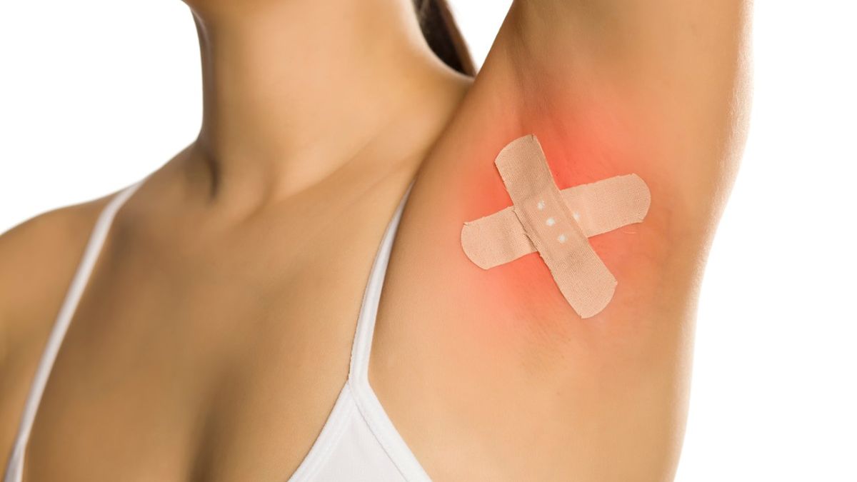 Wyprzenie skóry – przyczyny, objawy i leczenie