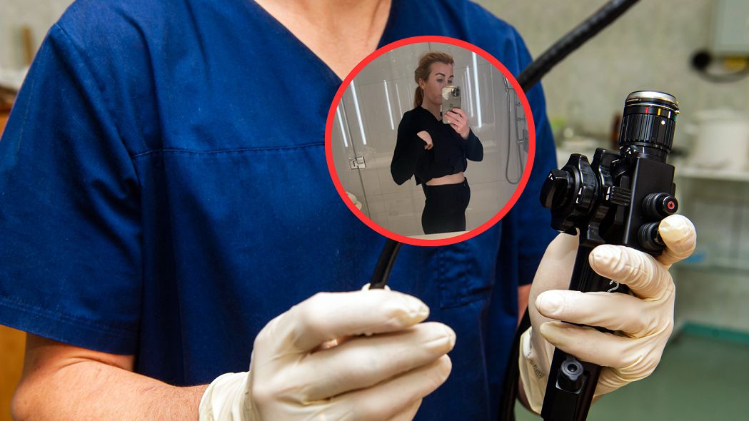 Rak jelita grubego dawał tylko 3 objawy. Nie zaniepokoiły 30-latki