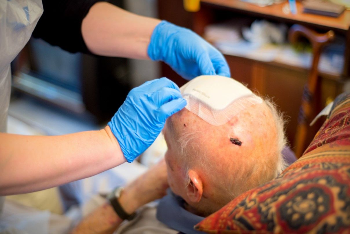 Krwiak mózgu – przyczyny, objawy, leczenie