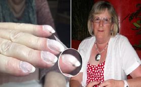 Manicure ocalił 73-latce życie. Zmiany na jej paznokciach były objawem raka płuc