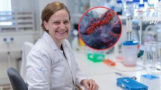 Bakteria może wspierać leczenie raka jelita. Obiecujące wyniki badania