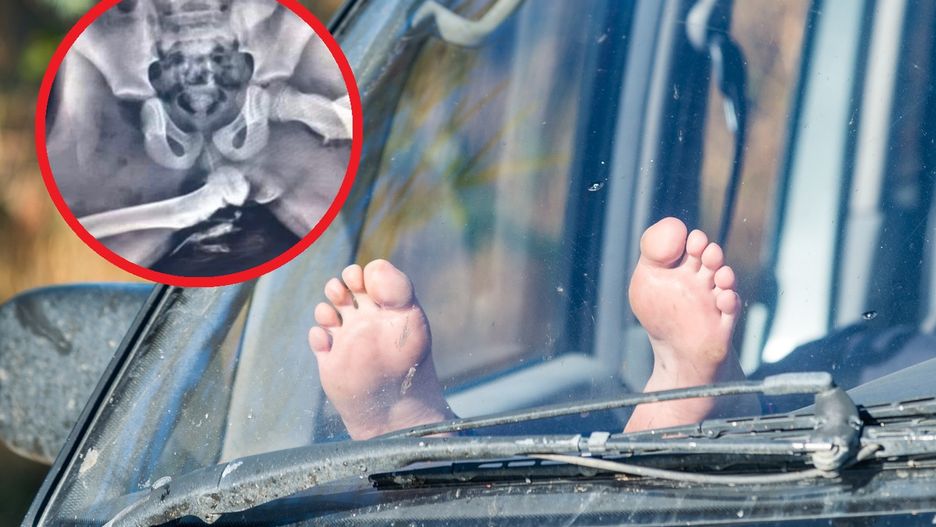Nigdy nie pozwalaj dziecku tak siedzieć w samochodzie. Może dojść do tragedii