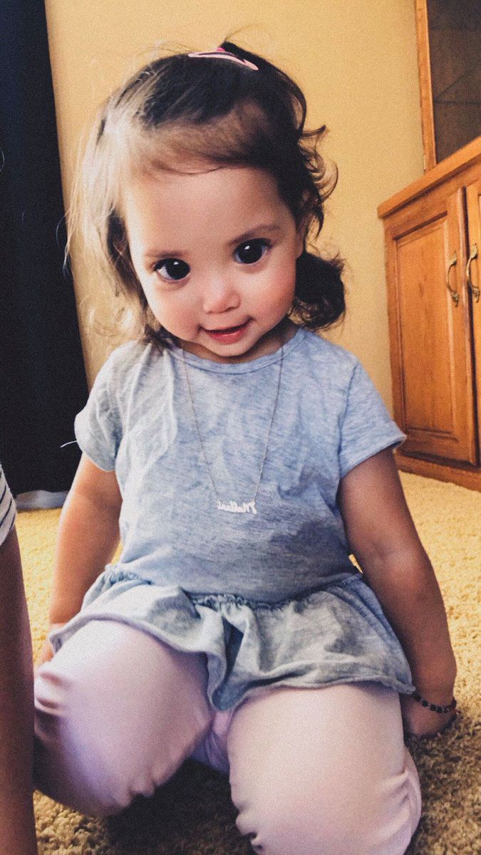 Wyjątkowy wygląd Mehlani to efekt choroby genetycznej