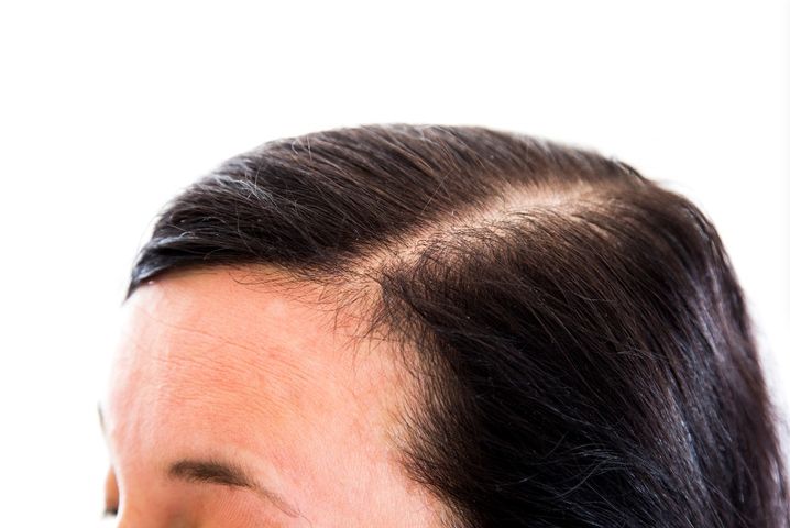 Zincuprin polecany jest osobom, które chcą poprawić kondycję skóry, ale również włosów i paznokci.
