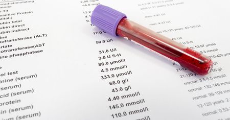 Hematolog - czym się zajmuje, jakie choroby leczy, przebieg wizyty, badania