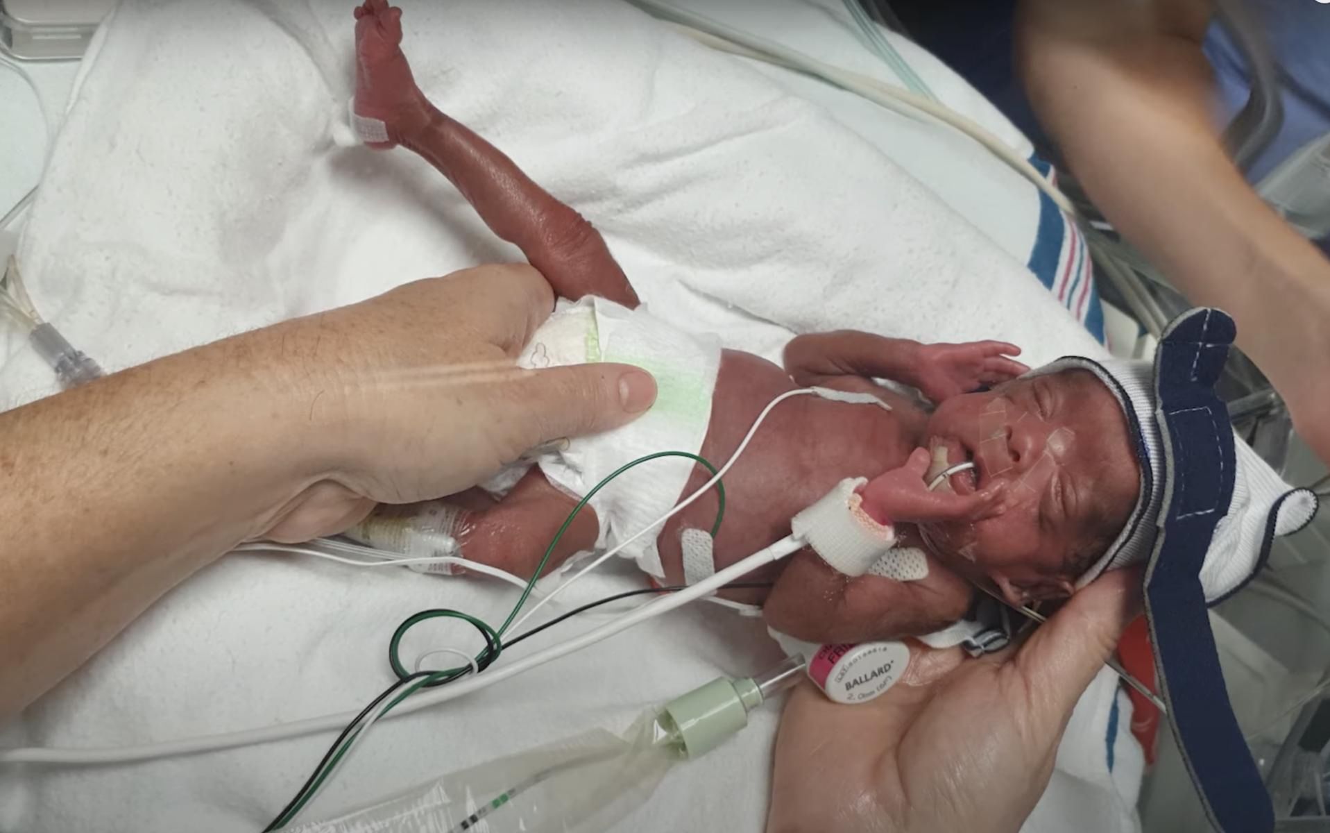 Dzieci ważyły razem 750 g