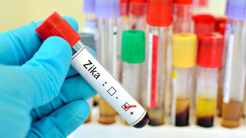 ZIKA groźna tylko dla kobiet w pierwszym trymestrze ciąży?