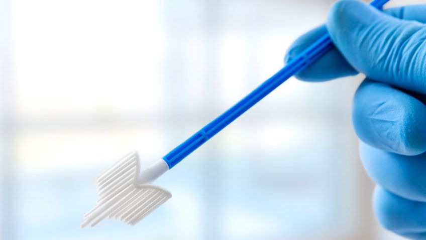 Regularnie wykonywana cytologia umożliwia wykrycie groźnych zmian