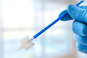 Cytologia – charakterystyka, przebieg badania, wyniki, leczenie