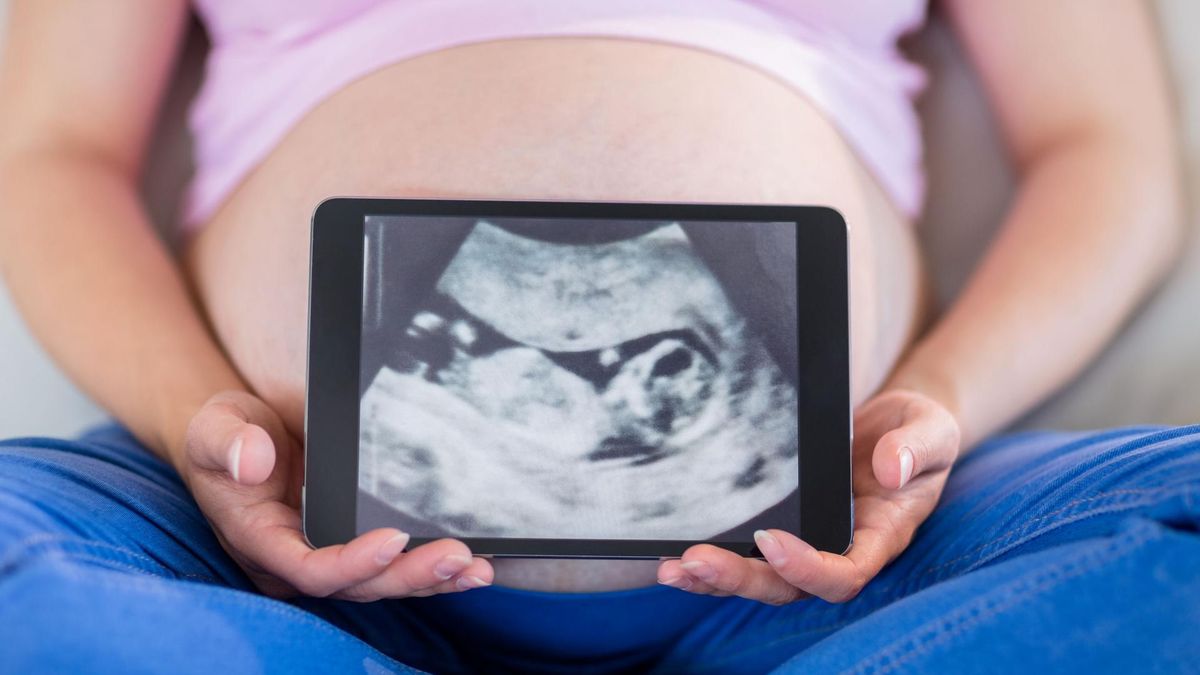 Kobieta trzyma zdjęcie dziecka z USG