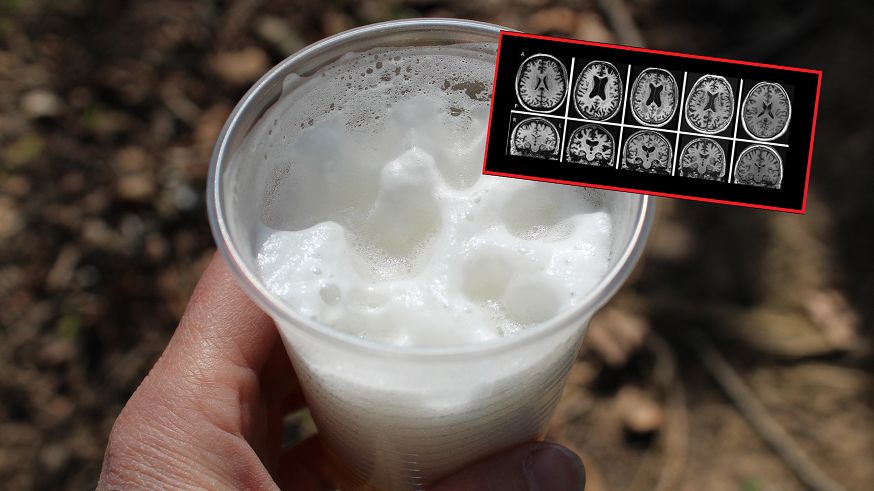 To alkohol robi z mózgiem. "Nie ma znaczenia, czy pijemy wódkę, czy piwo"