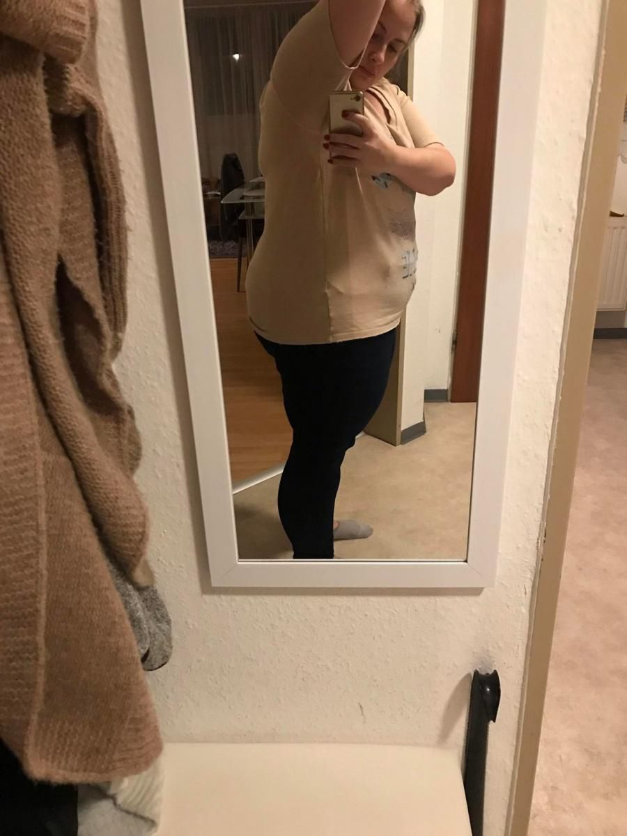 Pani Agnieszka przed operacją ważyła 121 kg