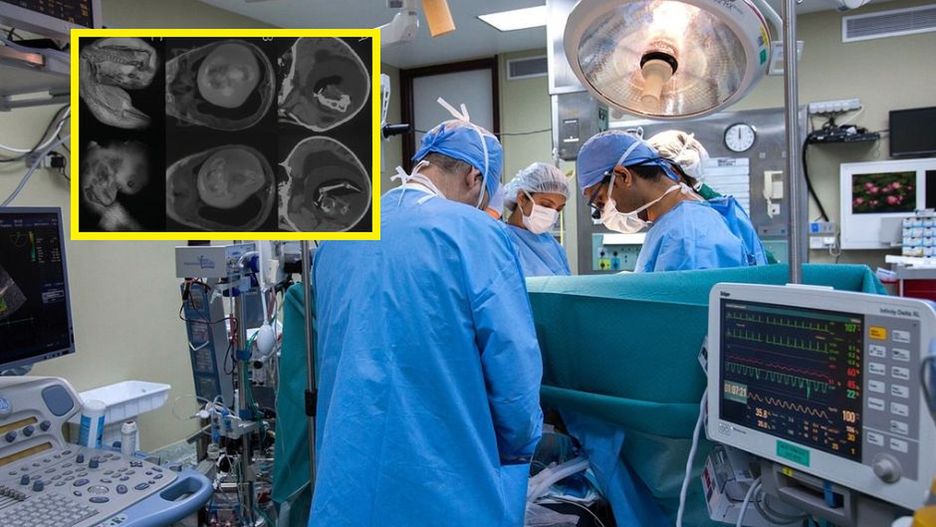 Głowa dziewczynki nieustannie rosła. W jej mózgu znajdowała się pasożytnicza bliźniaczka