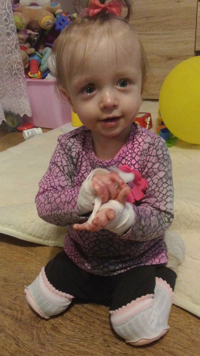 14-miesięczna Michalinka codziennie musi walczyć z bólem i cierpieniem