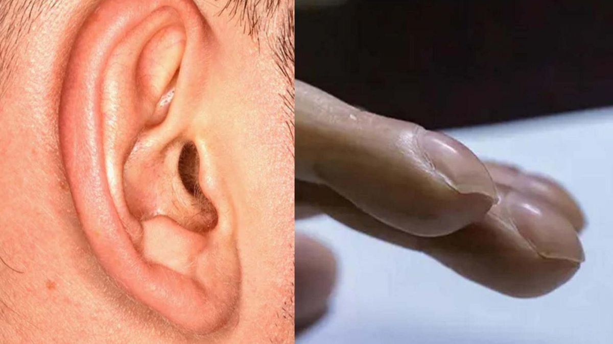 Nietypowe objawy świadczące, że serce nie daje rady