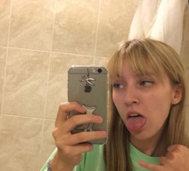 Uczulenie na wodę bardzo utrudnia życie Lindsay