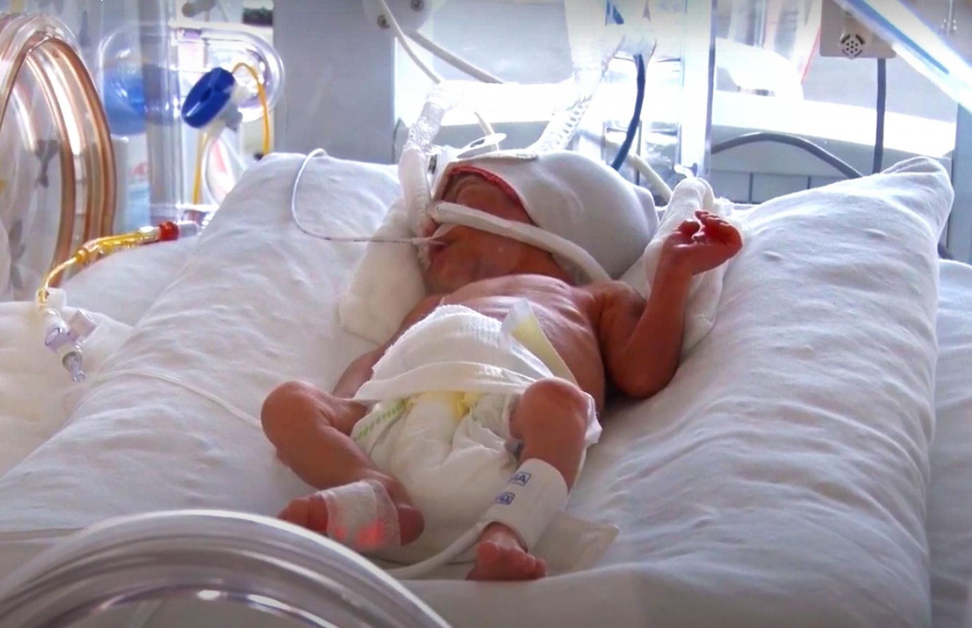 Nisa po urodzeniu ważyła niecałe pół kg