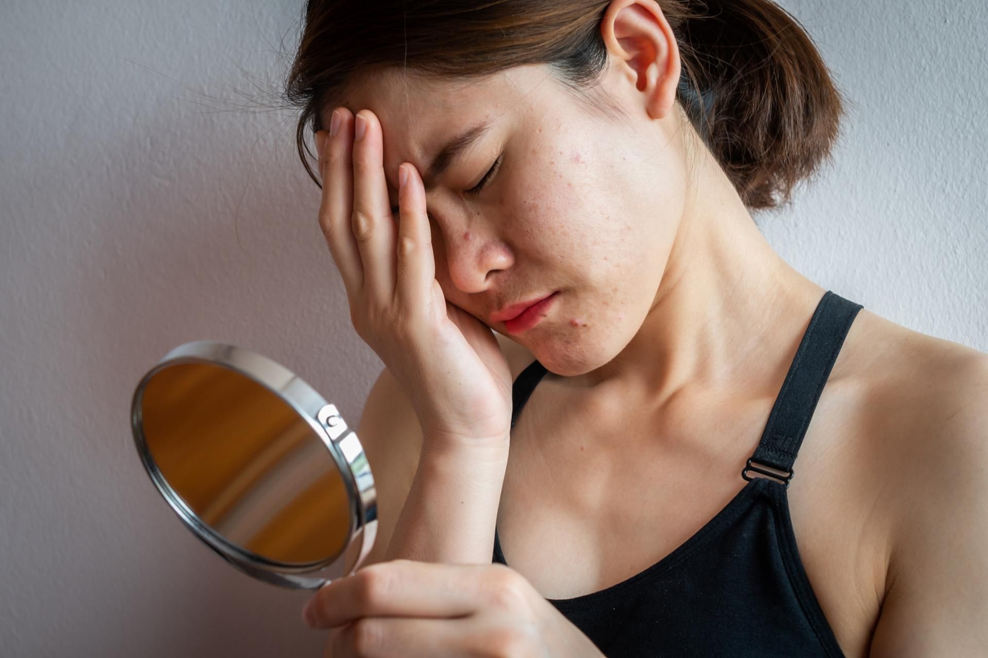 Picie alkoholu fatalnie wpływa na skórę