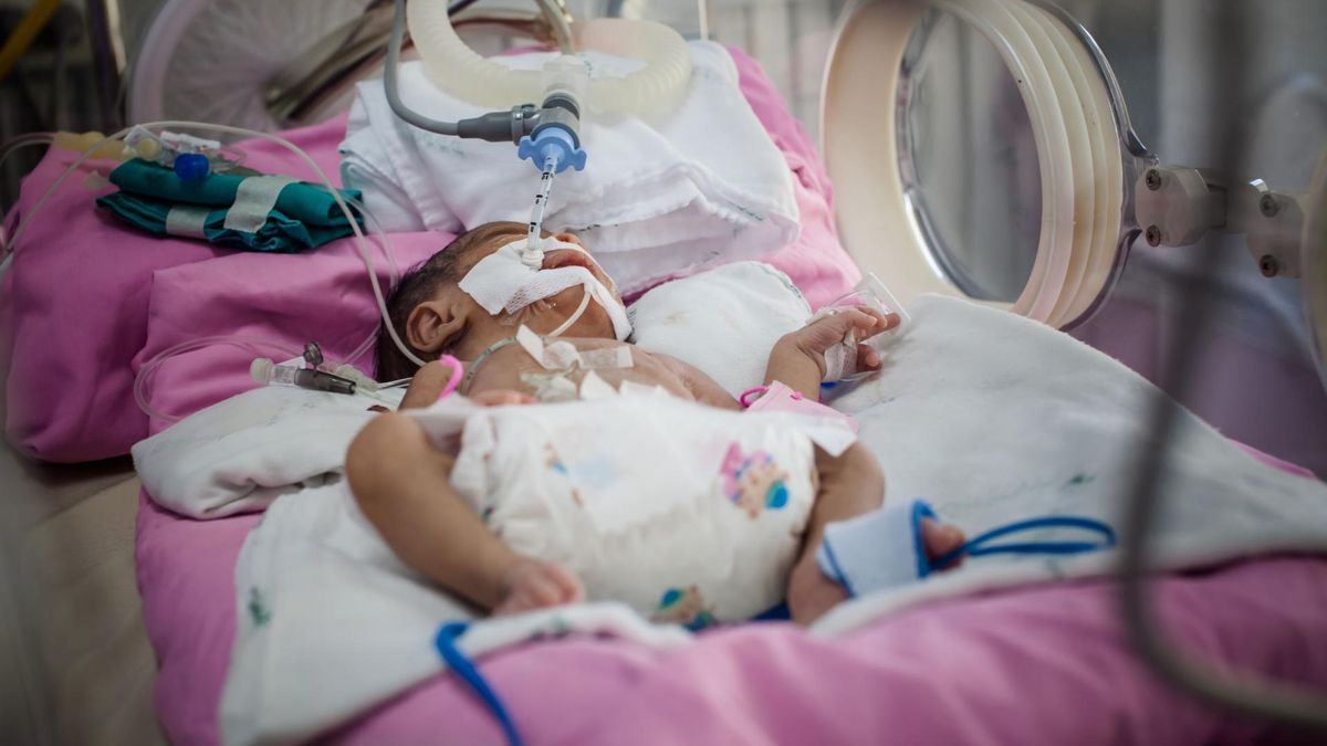 Krytycznym momentem, w którym można mówić o jakichkolwiek szansach na przeżycie dziecka jest według neonatologów 22. tydzień