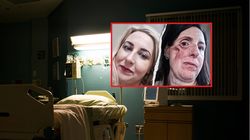 Nowotwór dał dwa objawy. "Straciłam połowę twarzy"