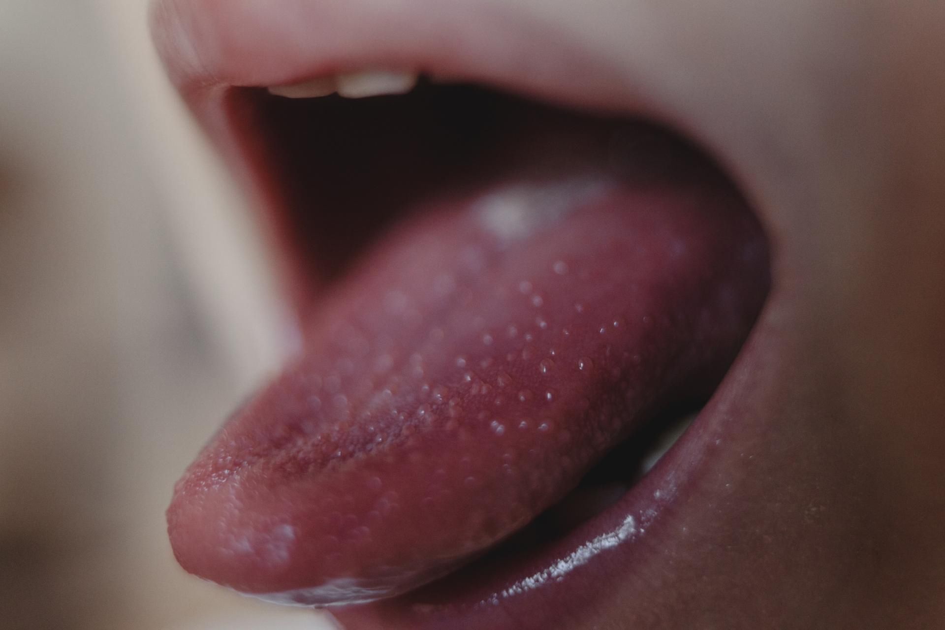 Malinowy język i drobna wysypka na skórze to może być szkarlatyna