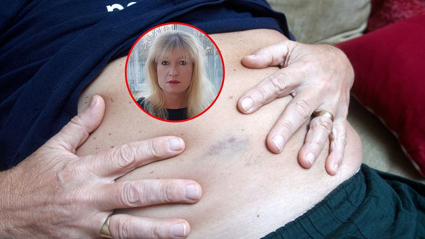 Wczesne objawy raka wątroby. Mogą być trudne do wykrycia