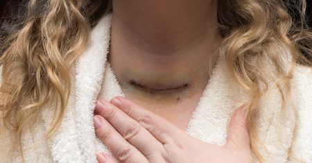 Dewastuje wątrobę i mózg, napędza raka. Toksyczny także dla tarczycy