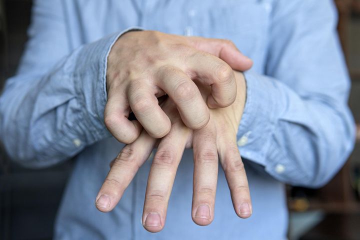 Świerzb - swędząca wysypka pojawia się m.in. w okolicach dłoni i nadgarstków