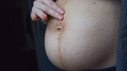 Linea negra - kiedy się pojawia? Kiedy znika?