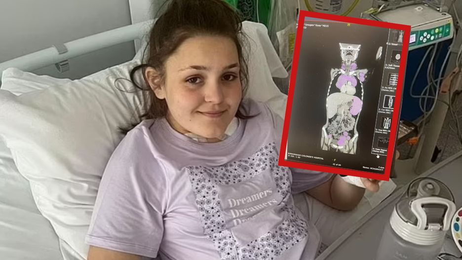 Pierwsze objawy choroby przypominały grypę. U 12-latki zdiagnozowano rzadki nowotwór