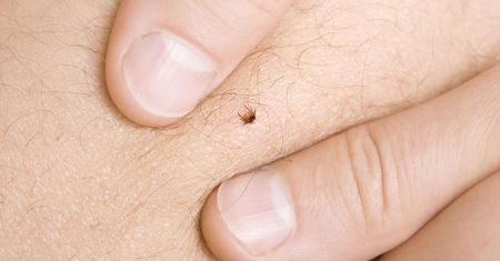 Objawy przewlekłej boreliozy. Ciężko je rozpoznać