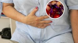 Ból jelit i wzdęcia? Winne mogą być te warzywa