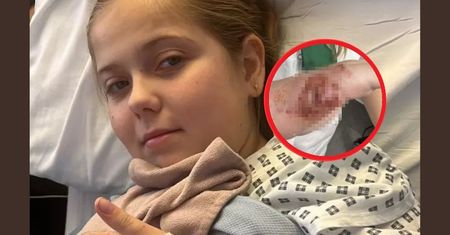 11-latka chciała mieć ładne paznokcie. Blizny zostaną do końca życia