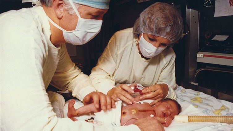 Dziecku przeszczepiono serca pawiana. Dziewczynka wkrótce zmarła