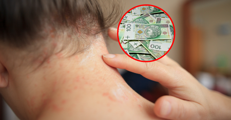 Milion Polaków choruje, większość nawet o tym nie wie. A mogą należeć się ulgi