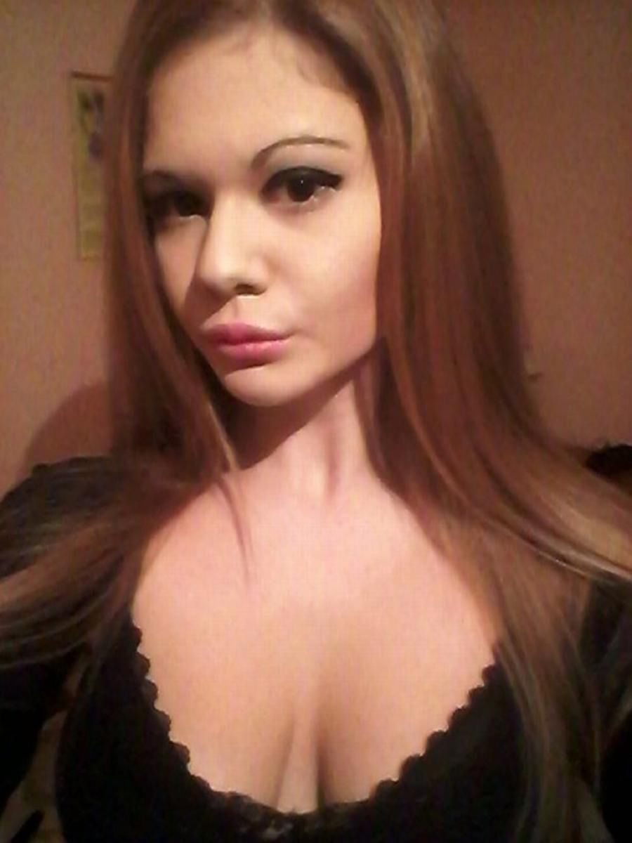 Tak wyglądała Andrea przed operacjami