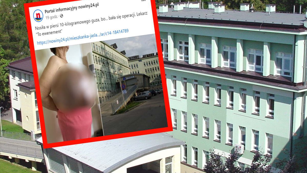 Mieszanka Jasła z ogromnym guzem. Lekarze nie mogli uwierzyć