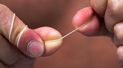 Przez 25 lat obserwowali ludzi, którzy nitkują zęby. Taki jest skutek