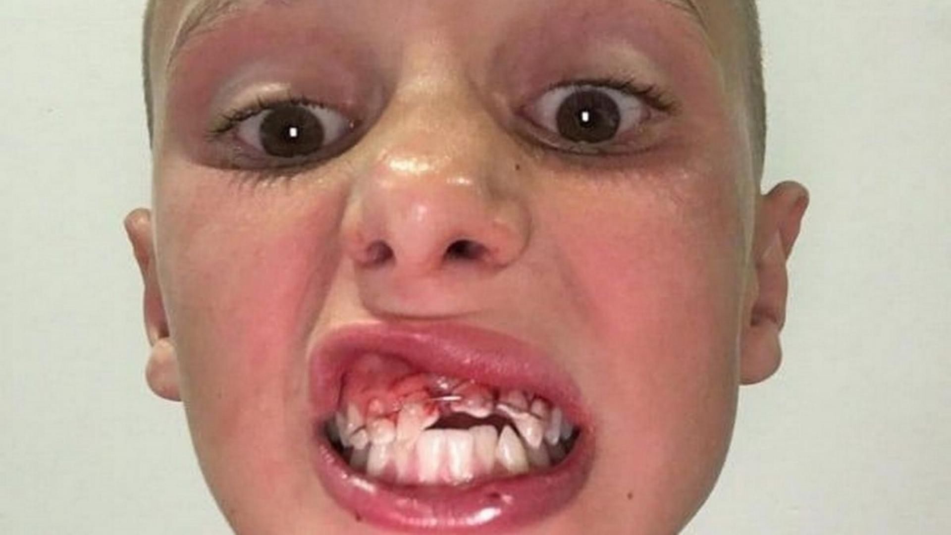 Groźny wypadek na basenie