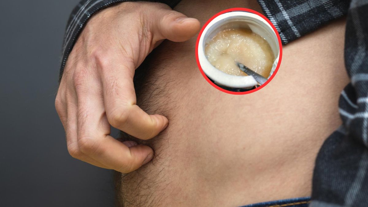 Naturalne sposoby na odtłuszczenie wątroby