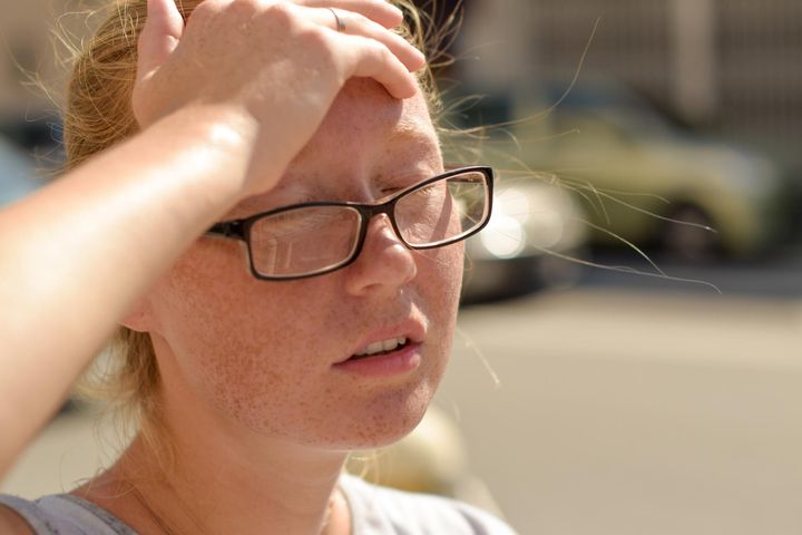 Typowe objawy udaru słonecznego to: nudności, wymioty, bóle głowy, osłabienie