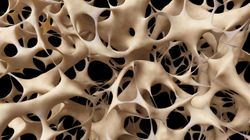 Choroby, które sprzyjają pojawieniu się kamicy nerkowej