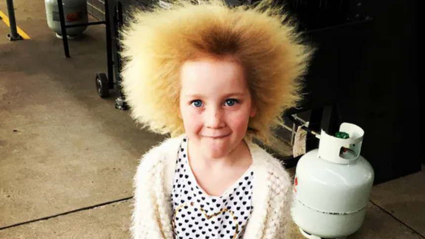 Pamiętacie dziewczynkę, która cierpi na "syndrom nieuczesanych włosów"? Ma już 14 lat